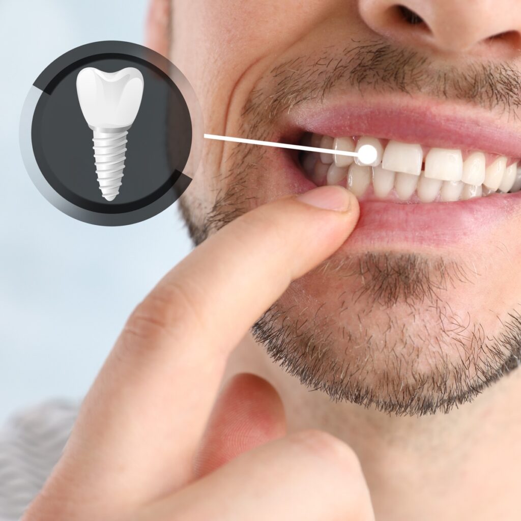 Special offer for new patients Rathgar Dental Special offer for new patients Rathgar Dental