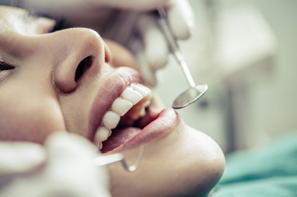 Fillings & Restorations Rathgar Dental Fillings & Restorations Rathgar Dental
